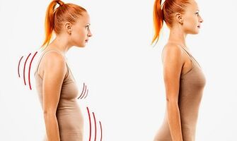 The reasons for the development of cervix osteochondrosis