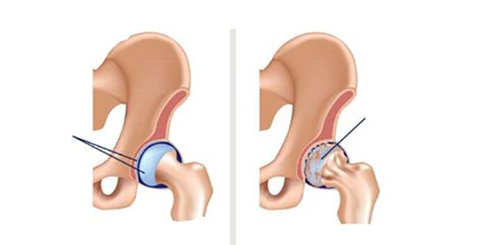 Features of the disease