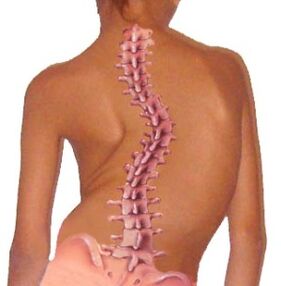 Curvature of the spine leads to osteochondrosis