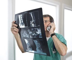 Myelography for the diagnosis of osteochondrosis and intervertebral hernias
